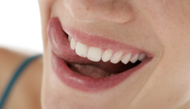 Frau mit makellos sauberen Zähnen, erzielt durch effektive Mundhygiene und die Verwendung einer Ultraschallzahnbürste