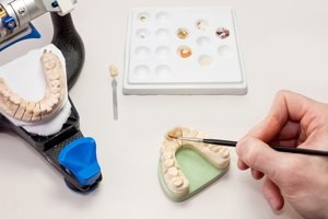 Zahnersatz Hannover Dental Labor