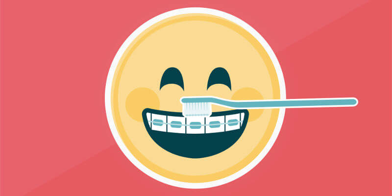 Die richtige Pflege der Zähne während der Tragedauer der Zahnspange ist von herausragender Bedeutung um Karies oder Zahnfleischentzündungen zu vermeiden